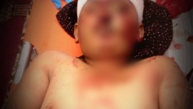 Photo of استشهاد طفل برصاص قناص حوثي في البيضاء