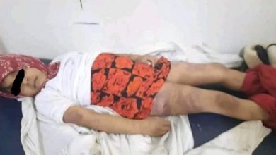 Photo of إب..وفاة طفلة تعذيباً على يد زوجة أبيها