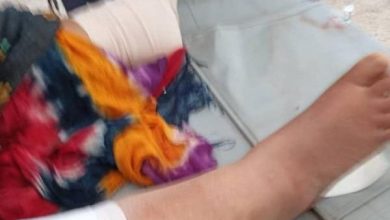 Photo of إصابة مسنة بقصف حوثي استهدف قرية “حمان” بالضالع