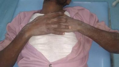 Photo of إصابة مدني بانفجار لغم من مخلفات الحوثيين في الخوخة