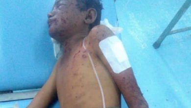 Photo of تقرير| 400 حالة وفاة خلال فترة الهدنة.. ومليشيا الحوثي تصعِّد أعمال العنف السياسي