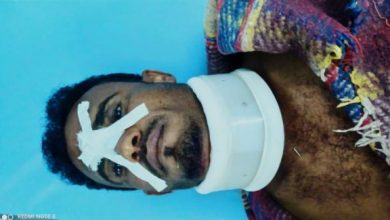 Photo of إصابة مدني بانفجار لغم حوثي فردي محرّم دوليًا زُرع داخل منزله جنوب الحديدة