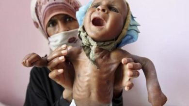 Photo of تفاقم أزمة انعدام الأمن الغذائي في اليمن