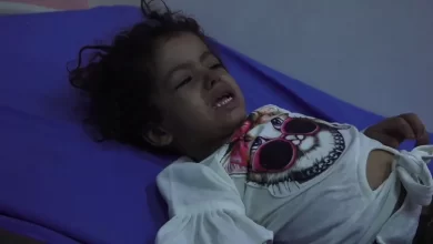 Photo of الأمم المتحدة: أكثر من 9 آلاف طفل يمني أصيبوا بالحصبة منذ بداية العام